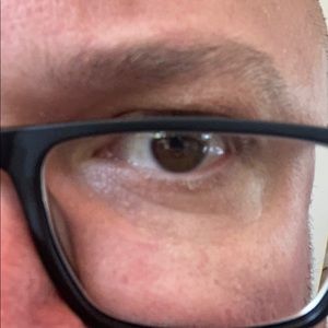 Meet your Posher, Melvin